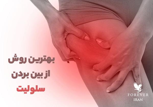 بهترین روش از بین بردن سلولیت